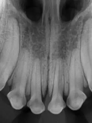 Dog and Cat Dental X-Rays in Boxborough, MA